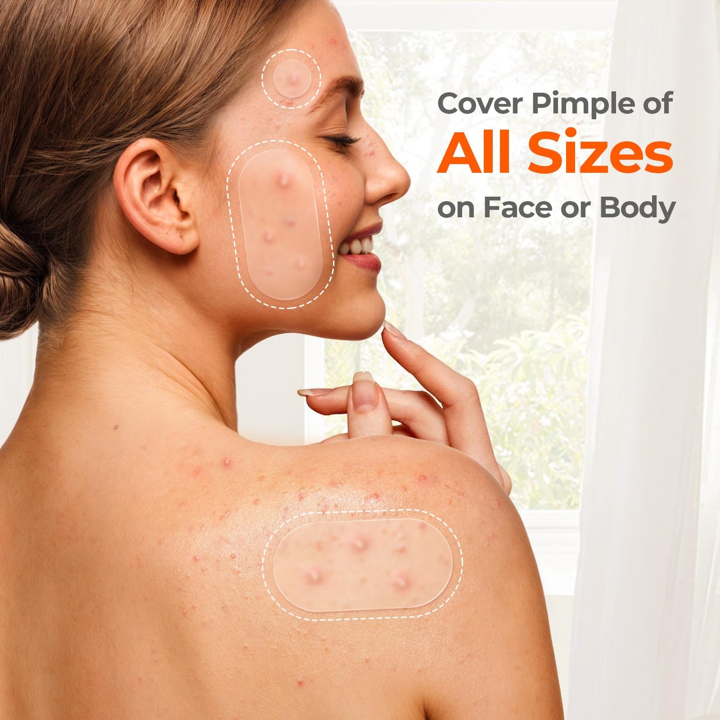 TKTK Chin Pimple Patches (100 Count 6 Sizes), XL Contoured Hydrocolloid Chin Patch 62x42 mm, Large Acne Patch for Face Blemishes Zit Breakouts, Maximum Absorption Overnight Stickers