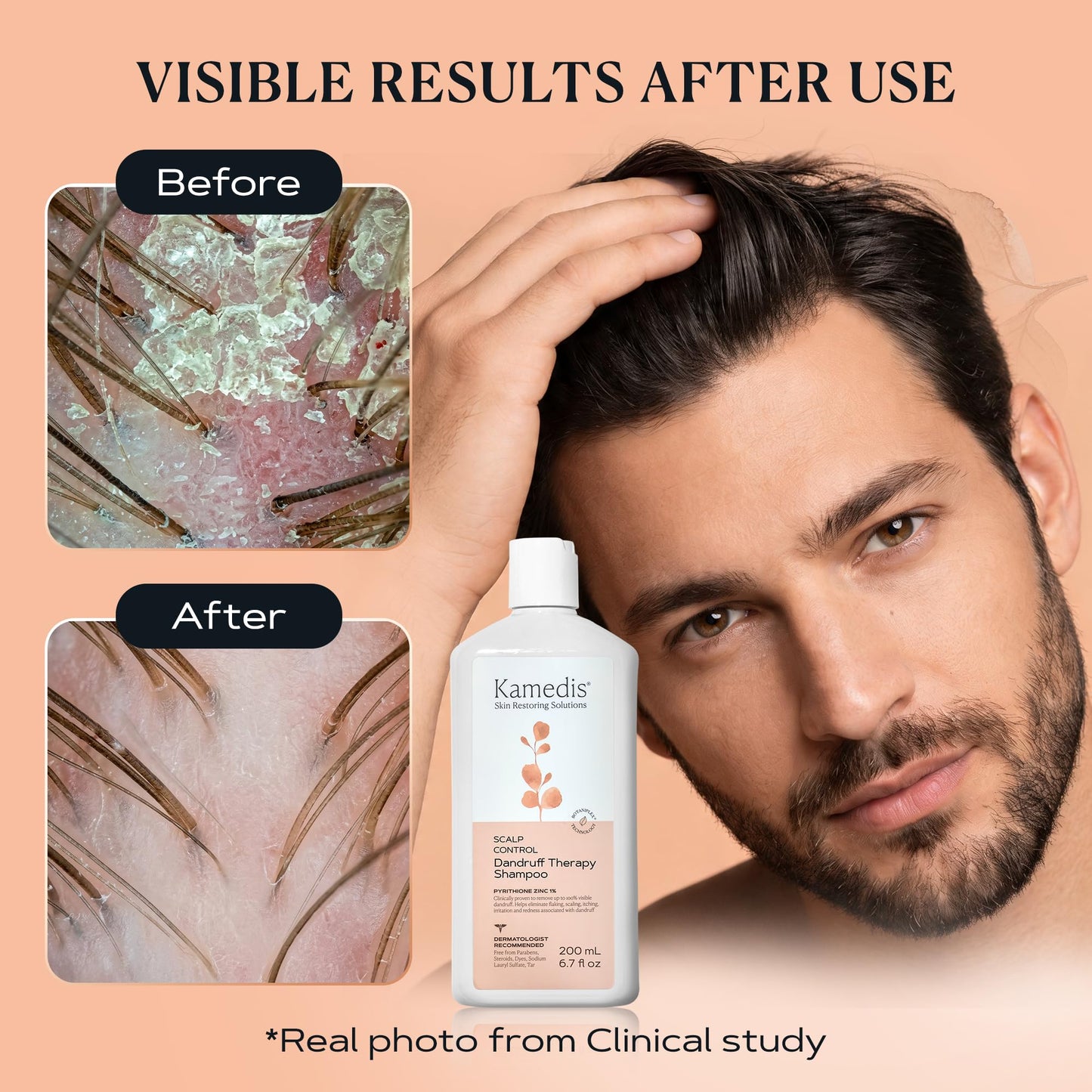 KAMEDIS Anti-Dandruff Therapy Shampoo
