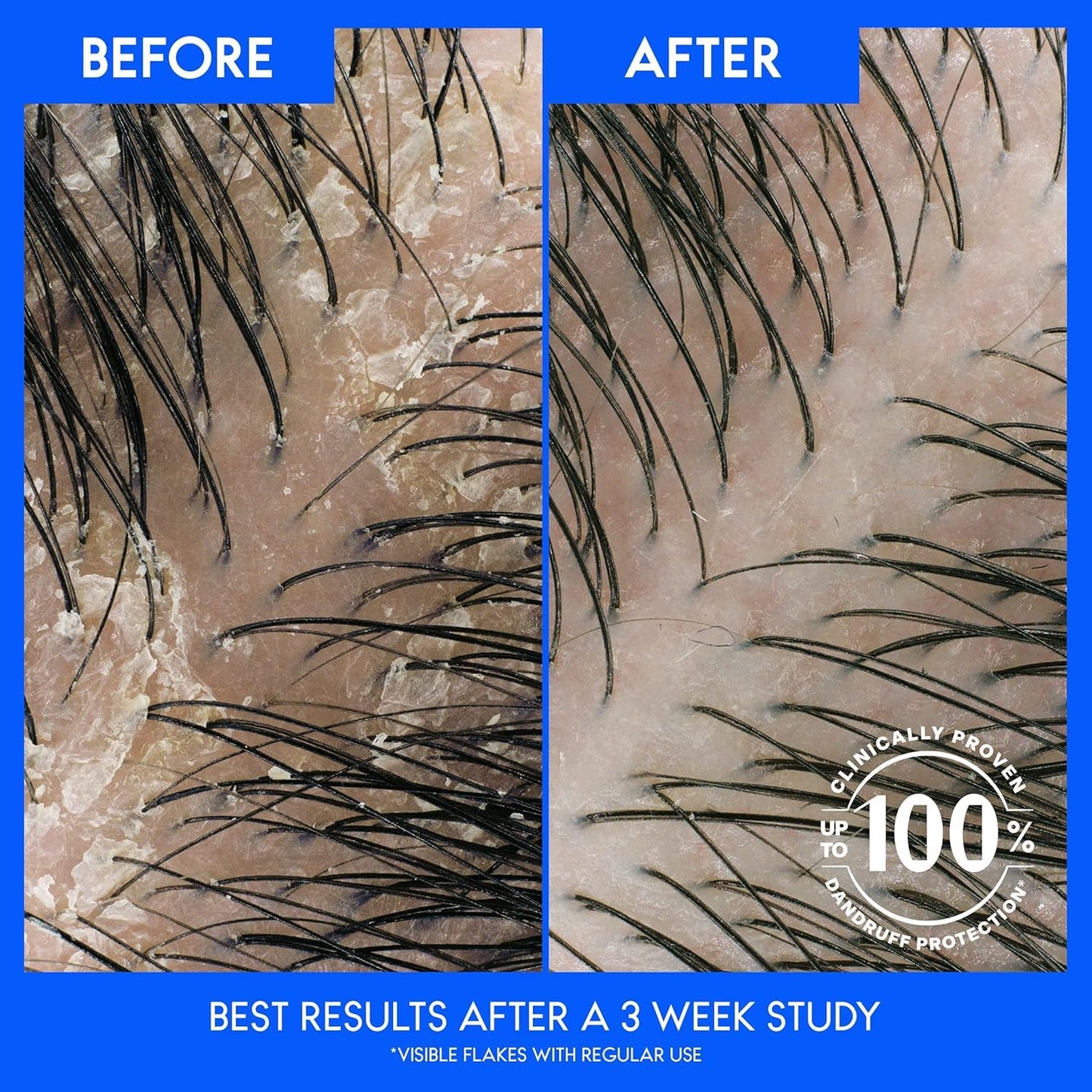 Head & Shoulders Classic Clean Dandruff Shampoo